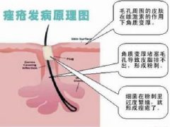 青春豆是怎么来的