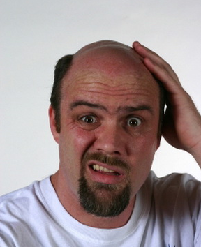 脱发的原因和治疗