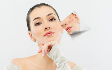 治疗痤疮哪种方法好